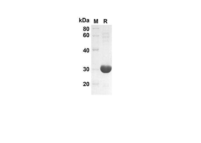 Recombinant Rat CD48 Protein(Fc Tag)-产品推荐-1
