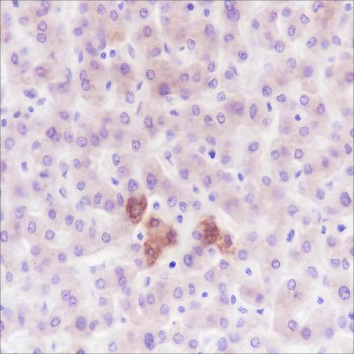 Recombinant PDK1 Monoclonal Antibody-searchlist-1