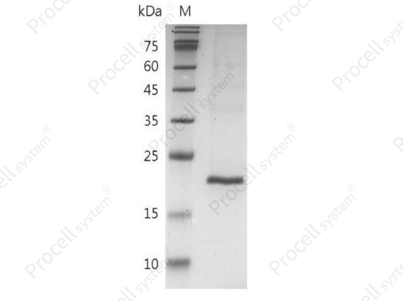 TNF-&beta;/TNFB/TNFSF1, Mouse, Recombinant
