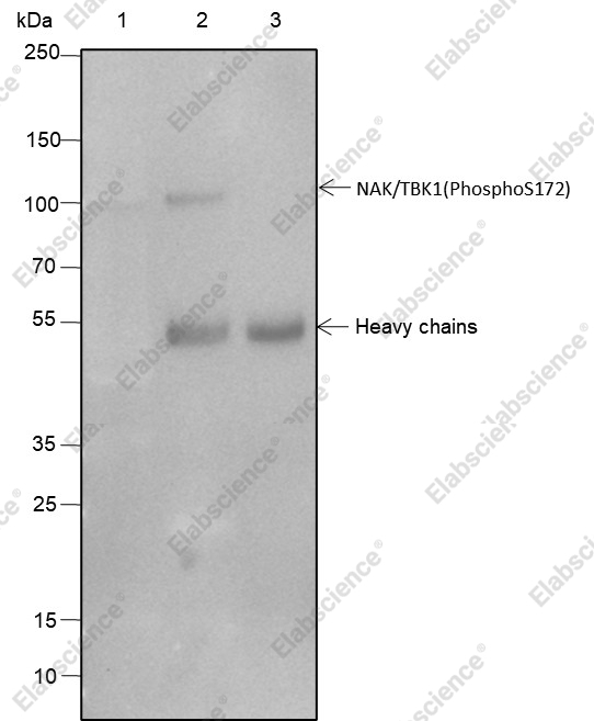 Recombinant Phospho-TBK1/NAK (Ser172) Monoclonal Antibody - 3