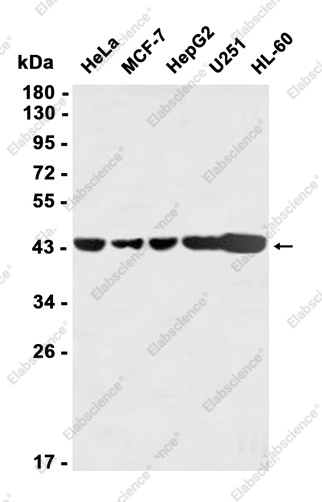 Recombinant RCC1 Monoclonal Antibody - 1