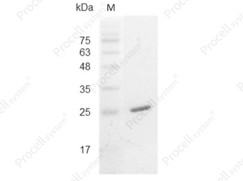 IL-30/IL-27/IL27-A, Mouse, Recombinant
