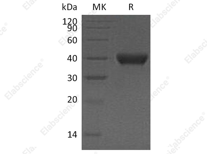 Recombinant Human RNASET2 Protein (Human Cells, His Tag) - 1
