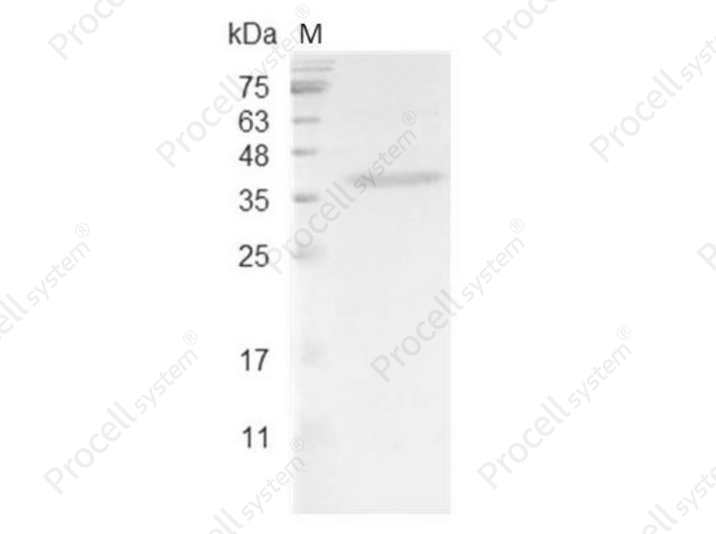 HDGF, Mouse, Recombinant - 1