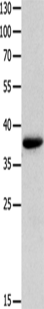 Western Blot analysis of Mouse muscle tissue  using MYOZ1 Polyclonal Antibody at dilution of 1:1000