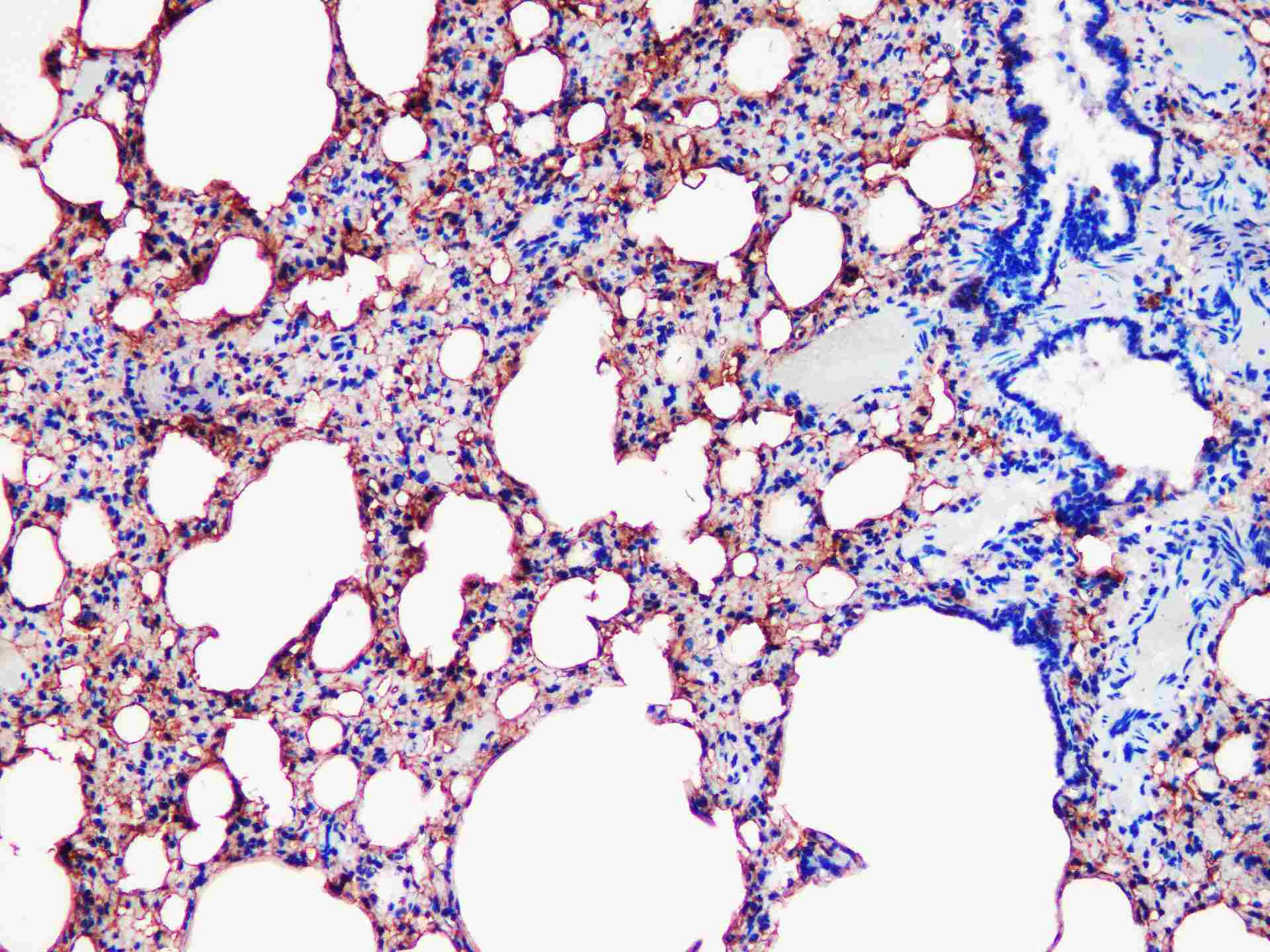 AGER Polyclonal antibody - small - 4