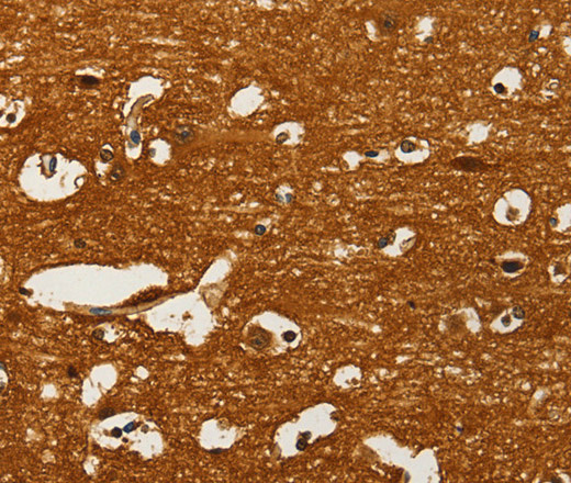 Immunohistochemistry of paraffin-embedded Human brain  using GOT1 Polyclonal Antibody at dilution of 1:50