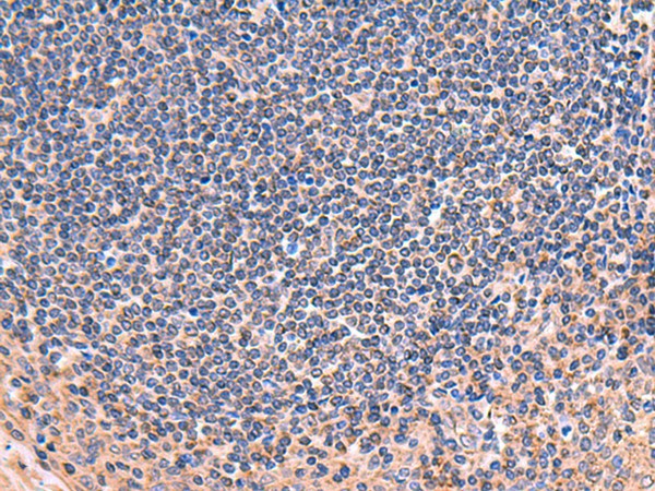 Immunohistochemistry of paraffin-embedded Human tonsil tissue  using ZNF256 Polyclonal Antibody at dilution of 1:70(?200)