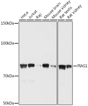 Western blot analysis of extracts of various cell lines using PIAS1 Polyclonal Antibody at 1:1000 dilution.