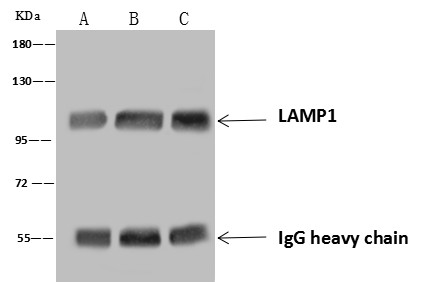 Recombinant LAMP1/CD107a Monoclonal Antibody - small - 5