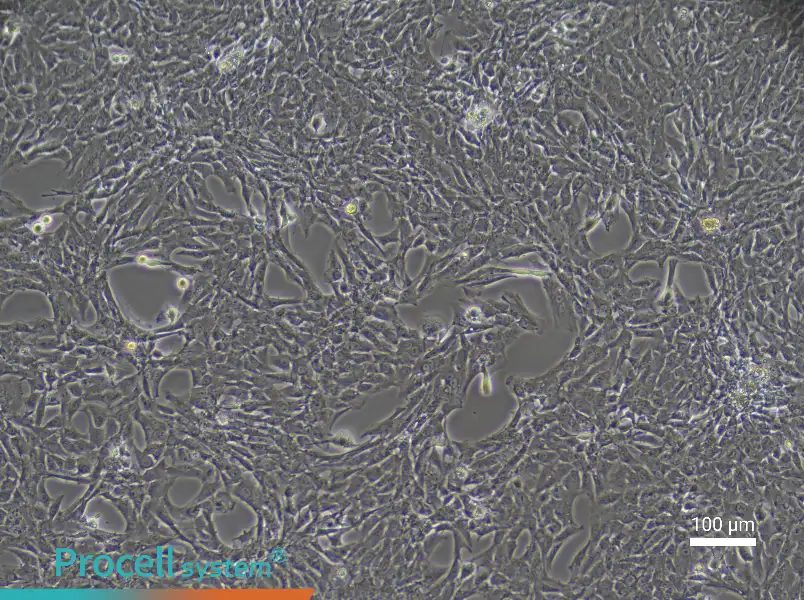 Rat Coronary Artery Smooth Muscle Cell Complete Medium - 3