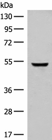 Western blot analysis of Human cerebella tissue lysate  using GLCCI1 Polyclonal Antibody at dilution of 1:400