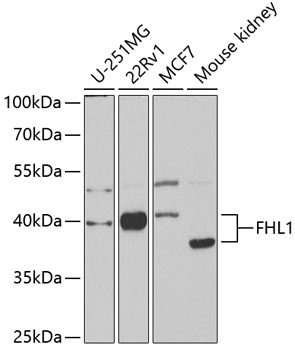 Western blot analysis of extracts of various cell lines using FHL1 Polyclonal Antibody at 1:1000 dilution.