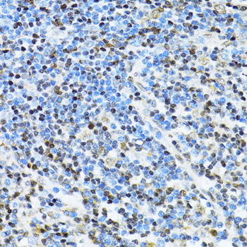 Immunohistochemistry of paraffin-embedded Human appendix using ITGB3BP Polyclonal Antibody at dilution of  1:100 (40x lens).