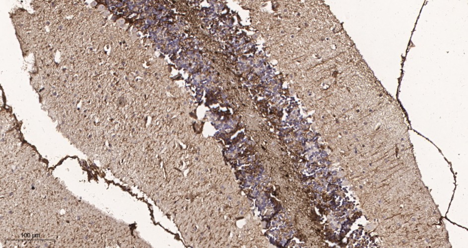 Recombinant GFAP Monoclonal Antibody - small - 3