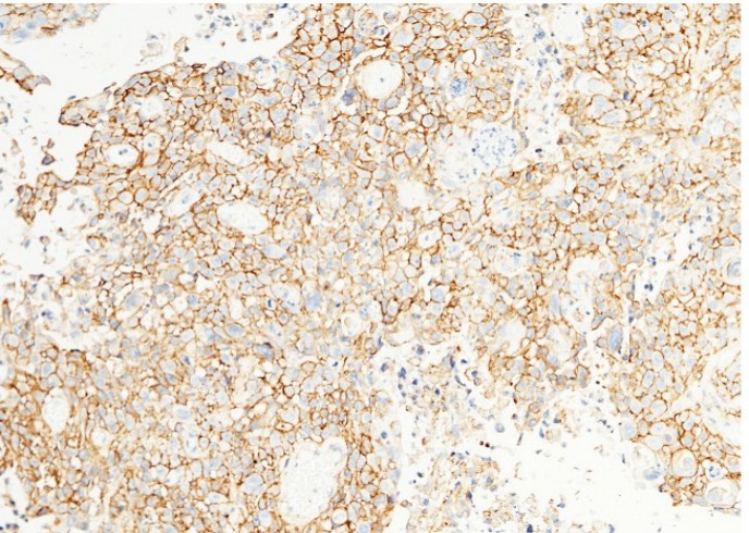CD44 Monoclonal Antibody - small - 3