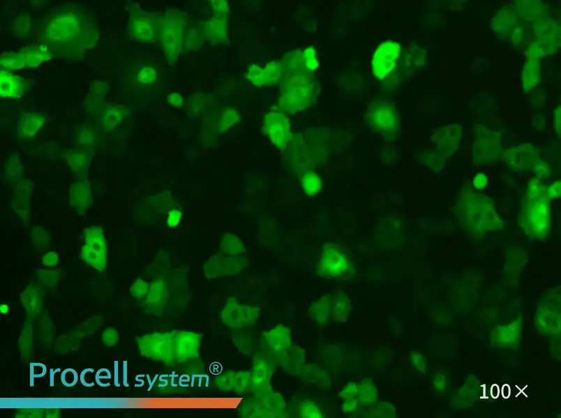 A549-GFP Cell Complete Medium - 1