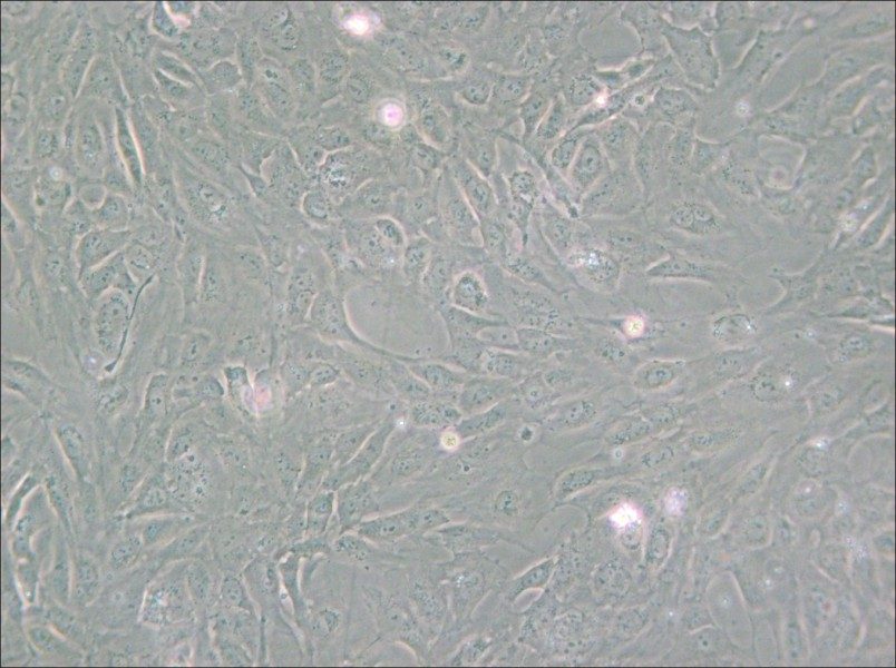 PUMC-HUVEC-T1 Cell Complete Medium - small - 4