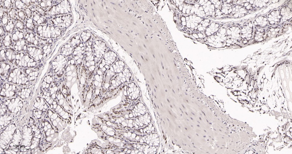 Recombinant KDM1A Monoclonal Antibody - small - 2