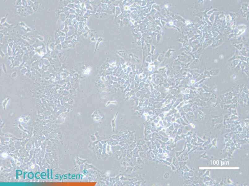 NCI-H2110NCI-H2110 - 2