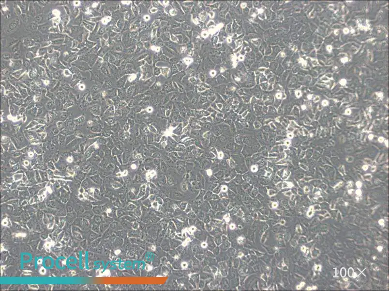 BPH-1 Cell Complete Medium - 2
