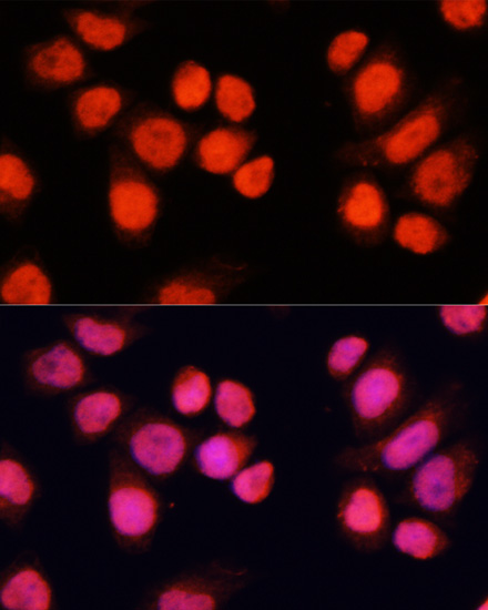 Immunofluorescence analysis of Hela cells using CHAMP1 Polyclonal Antibody at dilution of 1:100 (40x lens). Blue: DAPI for nuclear staining.