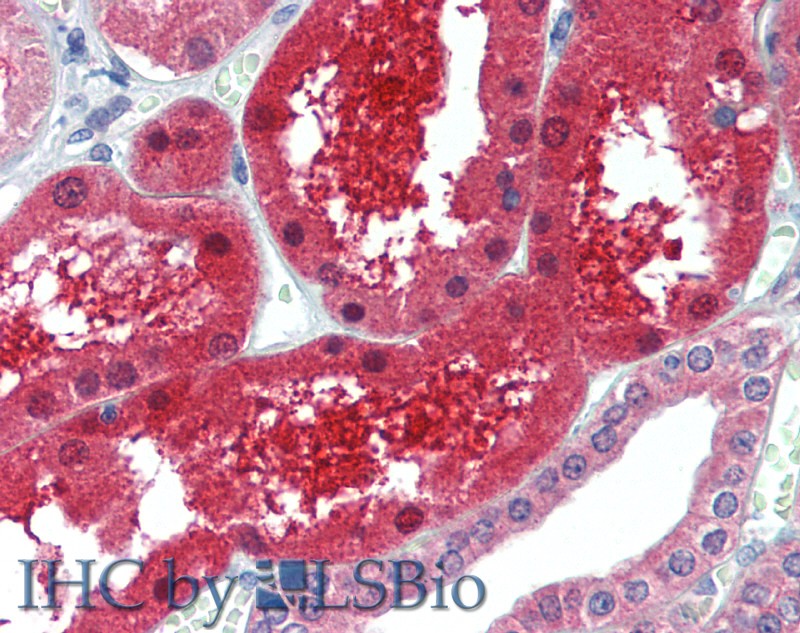 Immunohistochemistry of paraffin-embedded Kidney tissue using GPC6 Polyclonal Antibody at dilution of 1:100(Elabscience Product Detected by Lifespan).