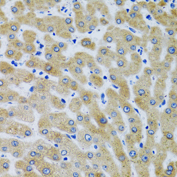 Immunohistochemistry of paraffin-embedded Human liver using MBL2 Polyclonal Antibody at dilution of 1:100 (40x lens).Perform microwave antigen retrieval with 10 mM PBS buffer pH 7.2 before commencing with IHC staining protocol