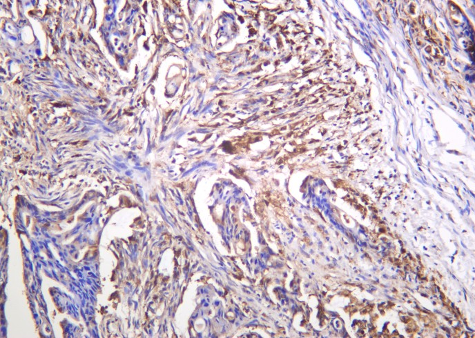 Recombinant Galectin-3 Monoclonal Antibody-searchlist-1