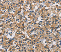 APOL1 Polyclonal Antibody - 3
