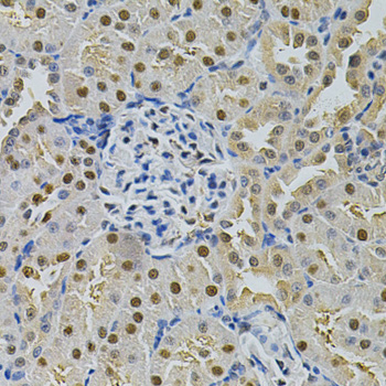 Immunohistochemistry of paraffin-embedded Rat kidney using SQSTM1 / p62 Polyclonal Antibody at dilution of 1:200 (40x lens).
