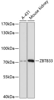 Western blot analysis of extracts of various cell lines using ZBTB33 Polyclonal Antibody at dilution of 1:3000.