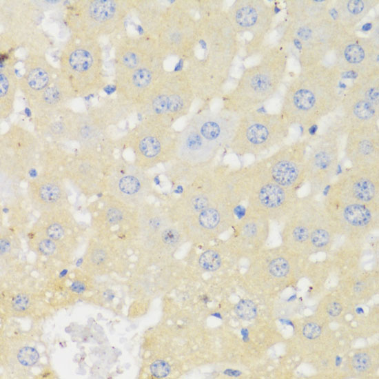 Immunohistochemistry of paraffin-embedded Mouse liver using CYP11A1 Polyclonal Antibody at dilution of  1:100 (40x lens).