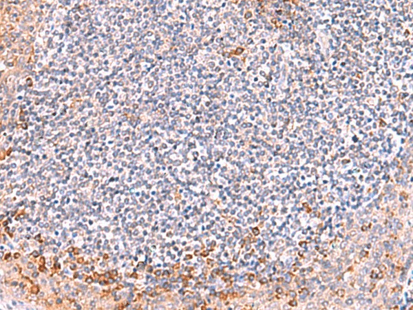 Immunohistochemistry of paraffin-embedded Human tonsil tissue  using ITSN2 Polyclonal Antibody at dilution of 1:40(?200)