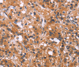 MAPK11 Polyclonal Antibody - 2