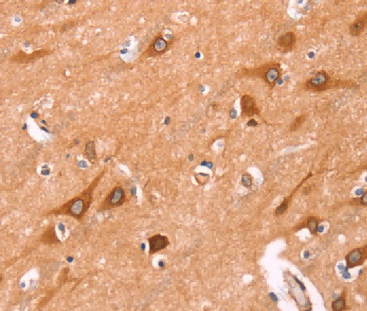 NCEH1 Polyclonal Antibody - 3