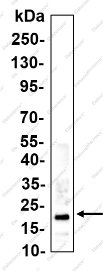 Recombinant Stathmin Monoclonal Antibody - 1