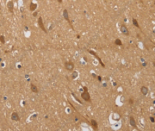 KCNQ4 Polyclonal Antibody - 3