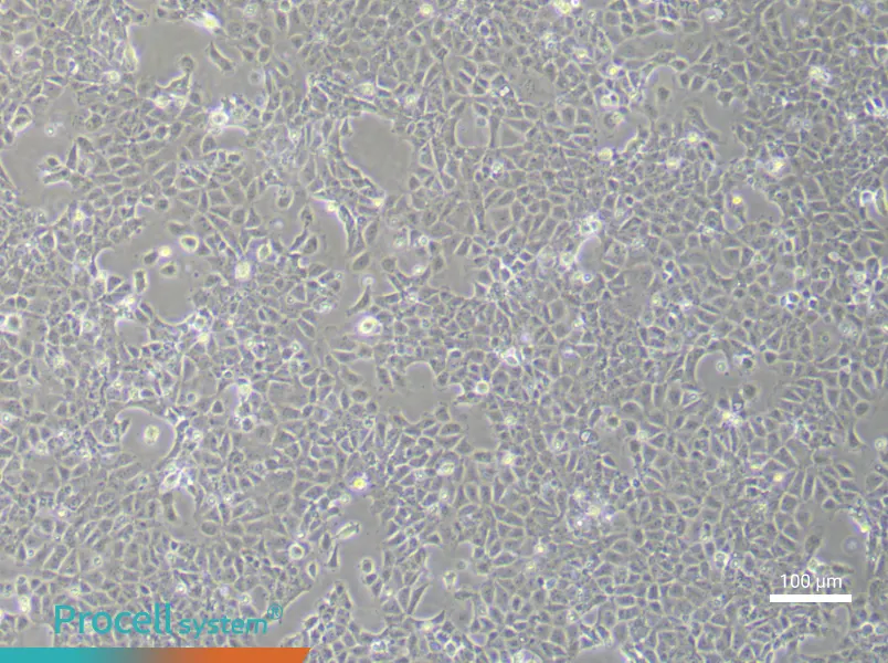 Rat Cardiac Fibroblasts (Primary cell immortalization)Rat Cardiac Fibroblasts (Primary cell immortalization) - 1