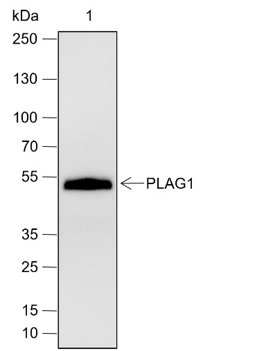 Recombinant PLAG1 Monoclonal Antibody-searchlist-1