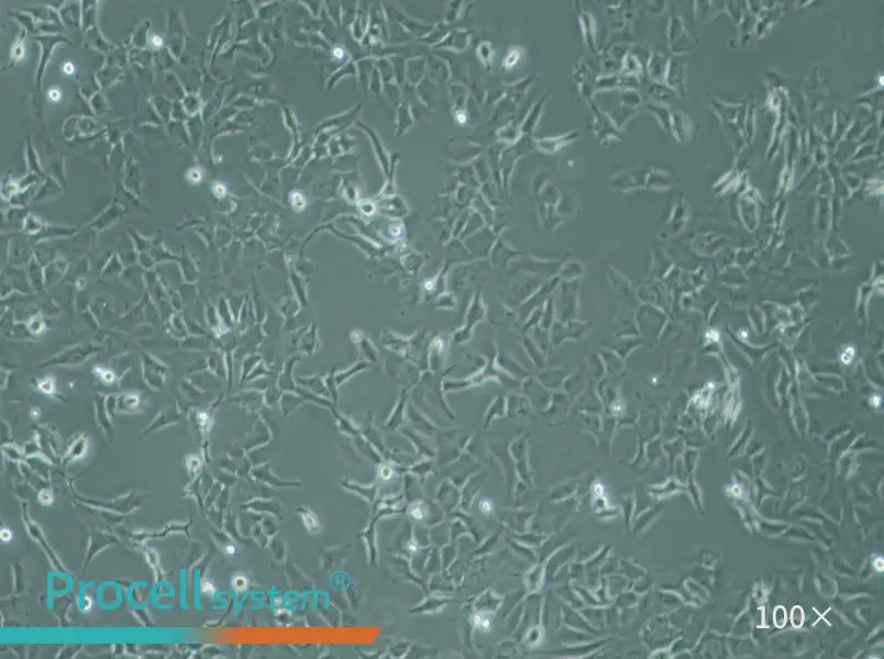 SK-OV-3 Cell Complete Medium - 3