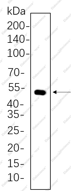 Recombinant Cytokeratin 14 Monoclonal Antibody - 1
