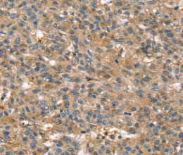 SSX2IP Polyclonal Antibody - 2