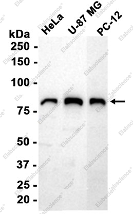 Recombinant ZYX Monoclonal Antibody - 3
