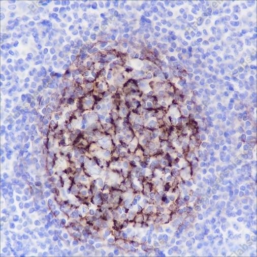 Recombinant Complement C4-B Monoclonal Antibody - 4