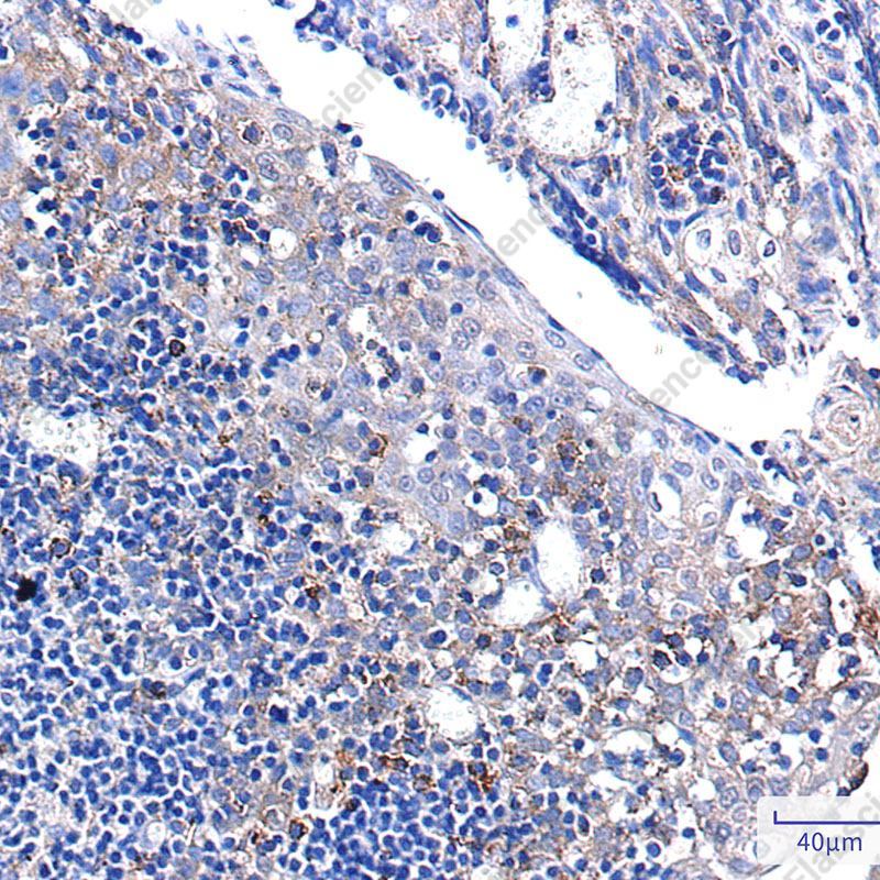 Recombinant Pumilio 1 Monoclonal Antibody - 3