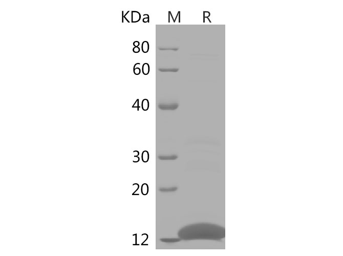 Recombinant Rat CD86 Protein(His Tag)-产品推荐-1