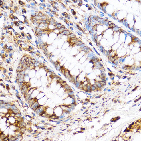 Immunohistochemistry of paraffin-embedded Human colon using PDXP Polyclonal Antibody at dilution of 1:100 (40x lens).Perform microwave antigen retrieval with 10 mM PBS buffer pH 7.2 before commencing with IHC staining protocol.