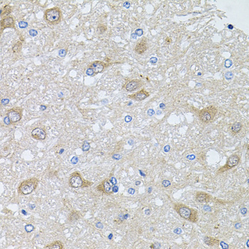 Immunohistochemistry of paraffin-embedded Rat brain using AKAP5 Polyclonal Antibody at dilution of 1:100 (40x lens).