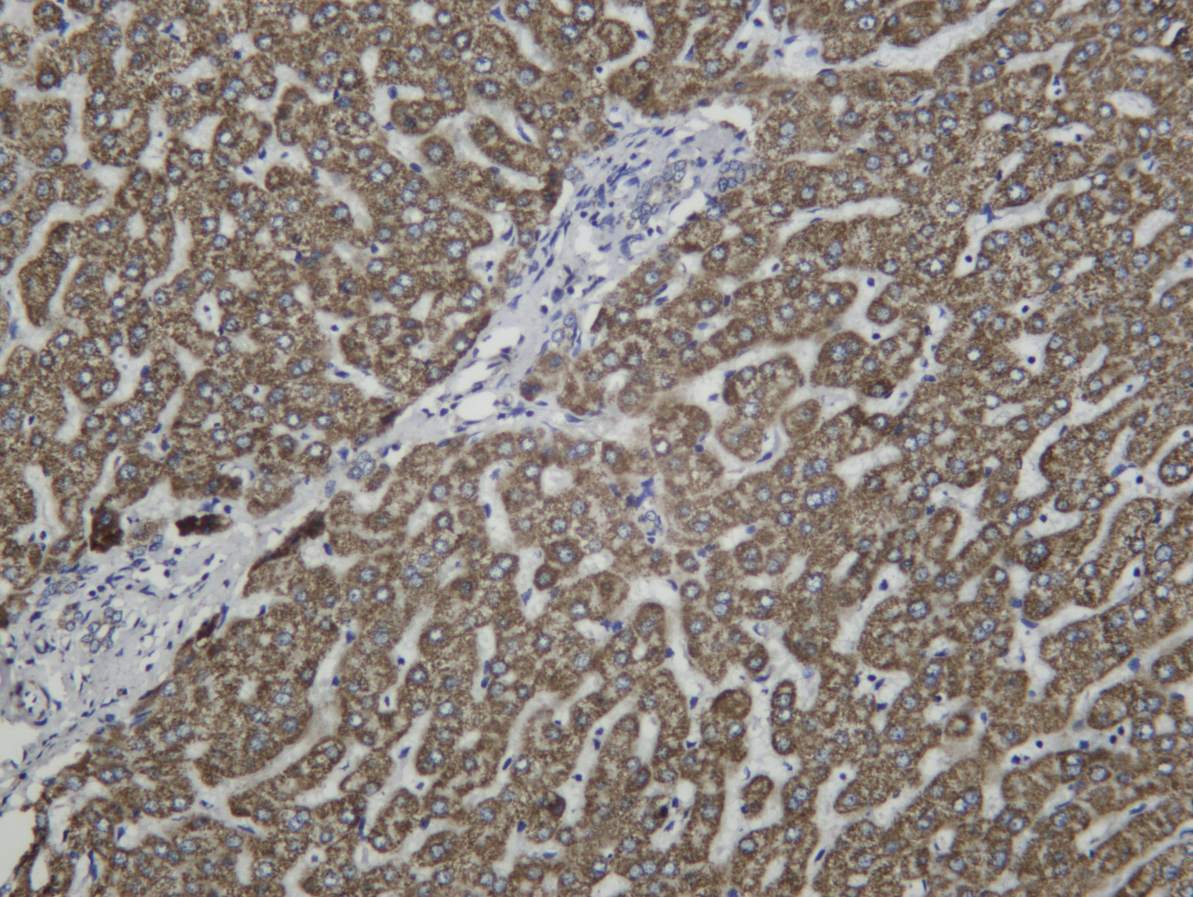 Recombinant MCAD Monoclonal Antibody - 1
